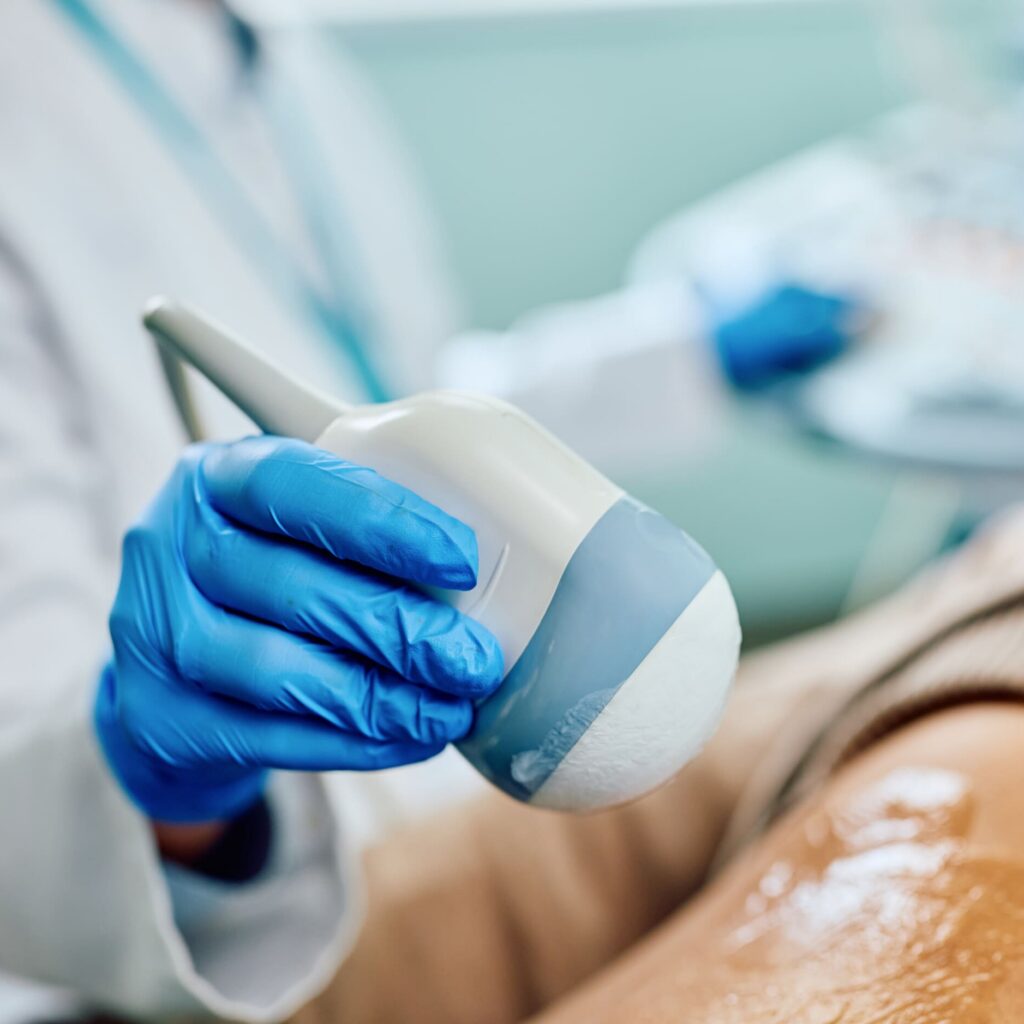 A medical professional wearing blue gloves holds an ultrasound probe, preparing to perform an ultrasound scan on a patients leg, which is covered in clear gel.